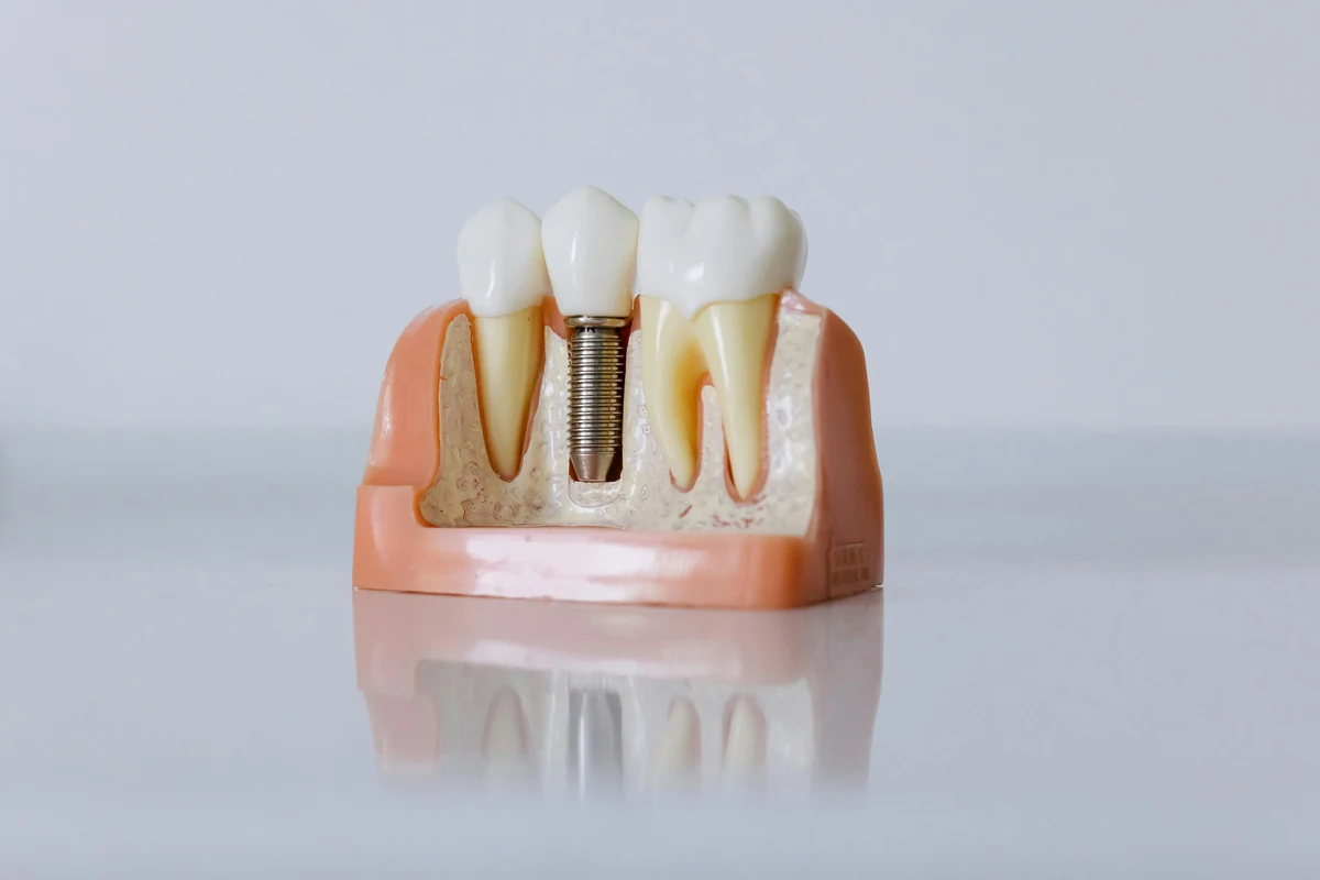 Restorative Dentistry