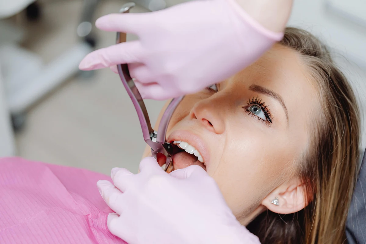 Wisdom Tooth Extraction
